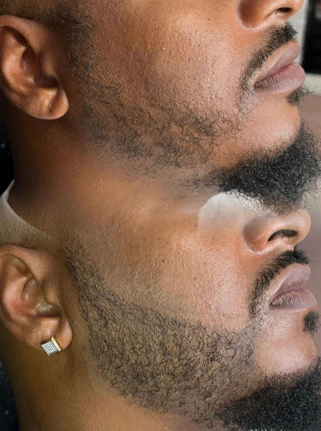 Beard & Hair SMP Deposit