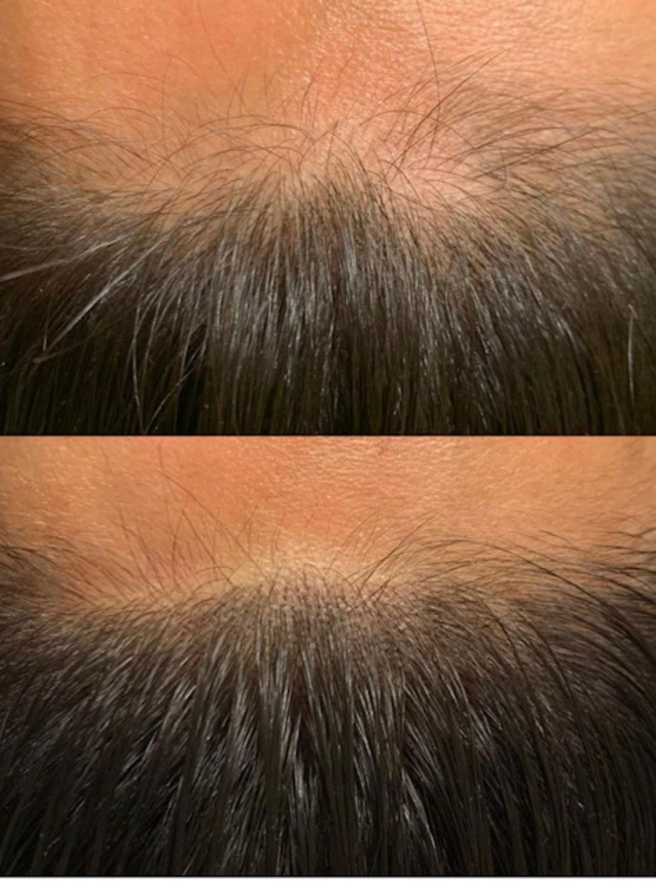 Hair SMP Deposit