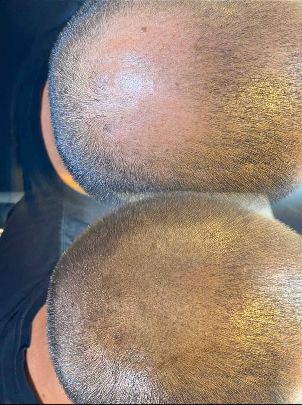 Beard & Hair SMP Deposit