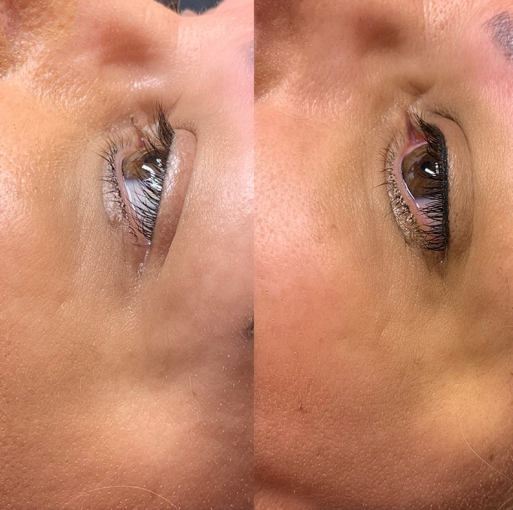 Permanent Makeup Eyeliner Deposit