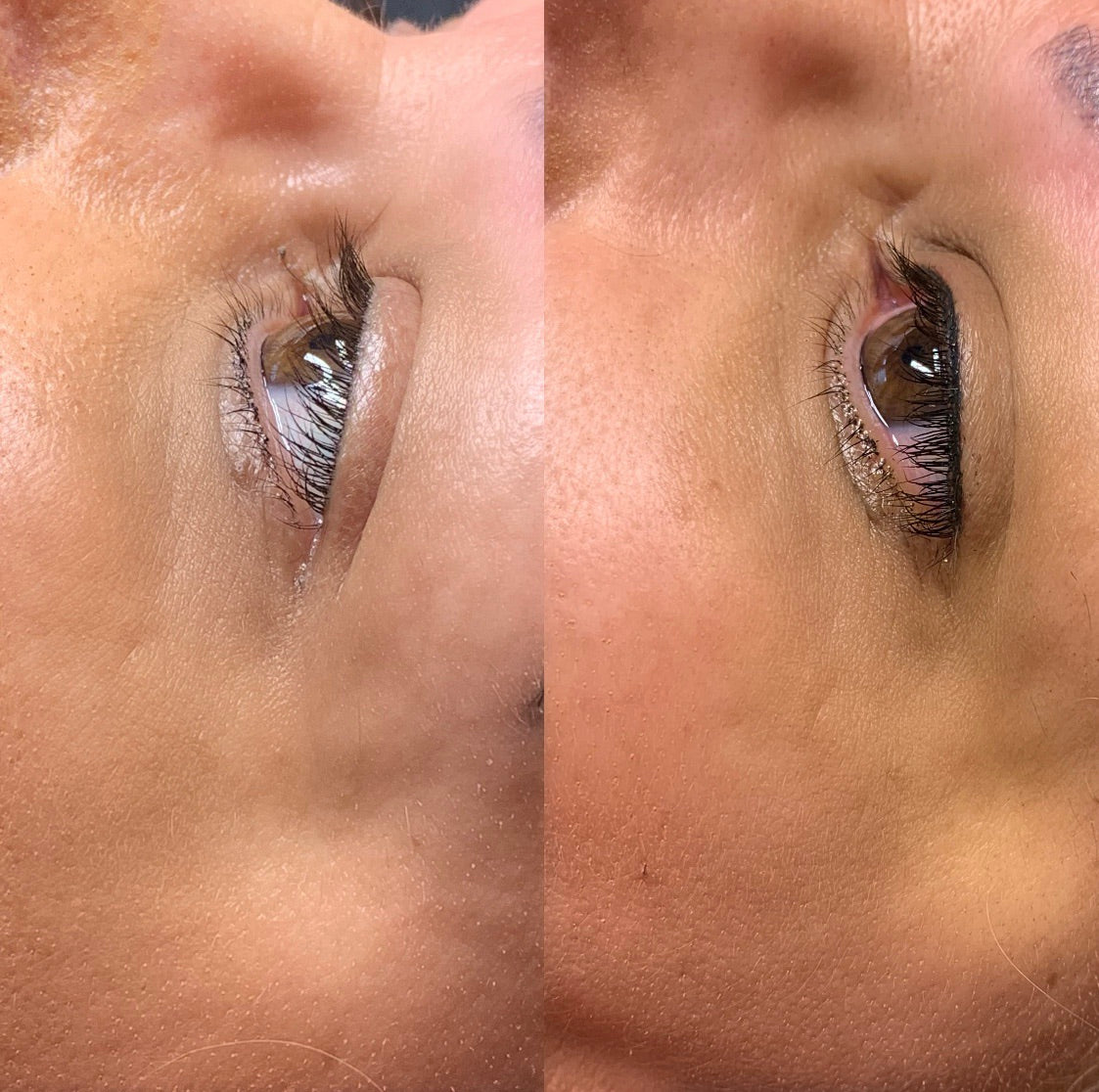 Permanent Makeup Eyeliner Deposit